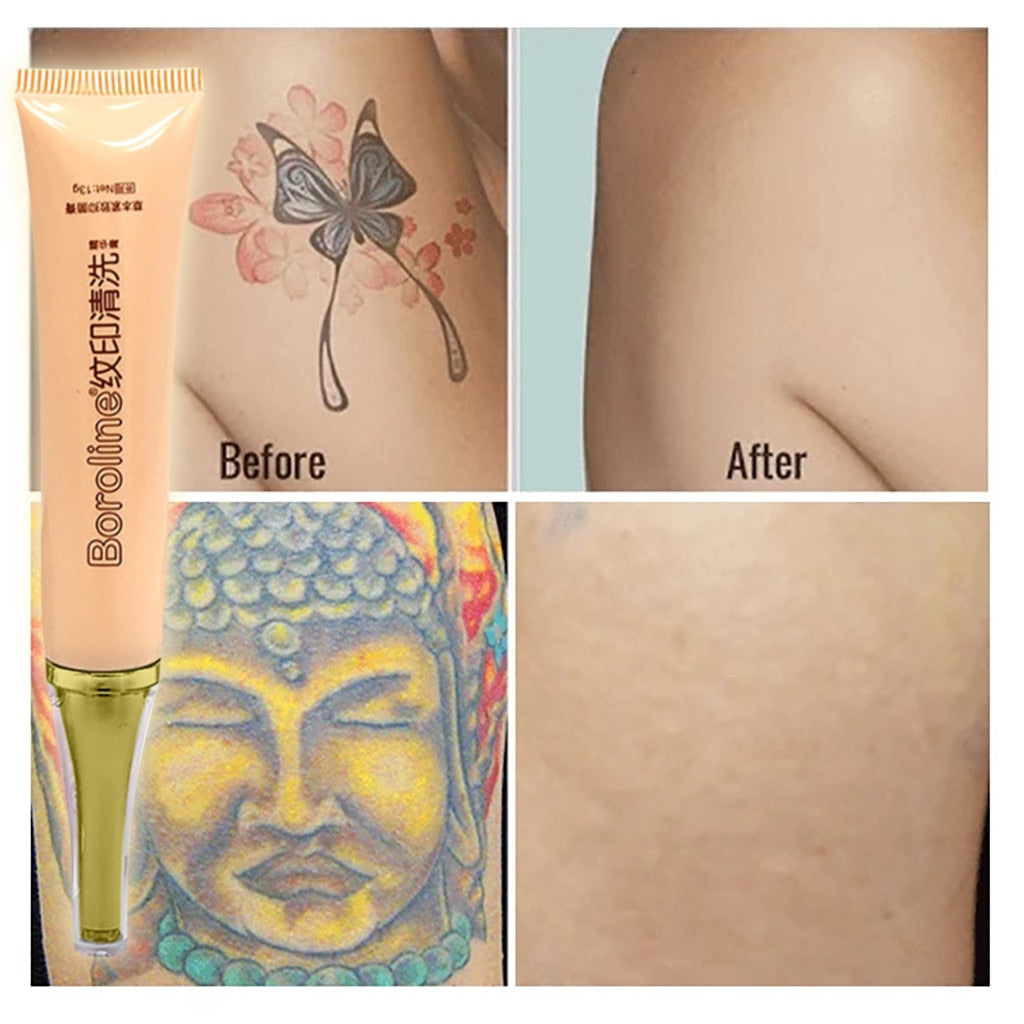 thINK Tattoo removal Cream - YouTube