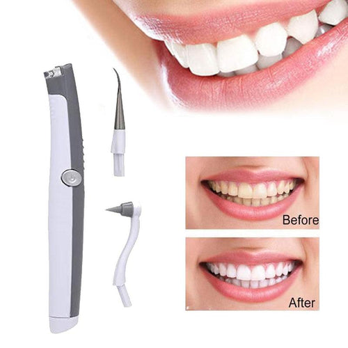 Electric Ultrasonic Tooth Stain Remover