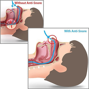 Anti Snore Stopper Nose Clip
